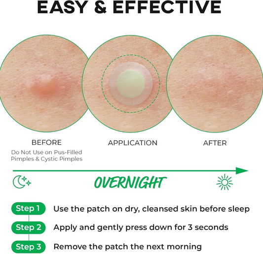 Nolahour - Acne patch, Spot Eraser Green Step1