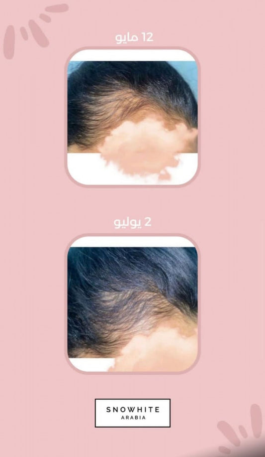 SW - Magical Hair Growth Spray